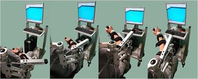 Upper Limb Interactive Weightless Technology-Aided Intervention and Assessment Picks Out Motor Skills Improvement in Parkinson's Disease: A Pilot Study